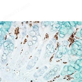 Anti-DNA/RNA Damage Antibody 15A3抗体